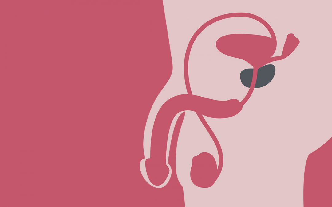 Cáncer de próstata